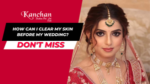 How Can I Clear My Skin Before My Wedding?